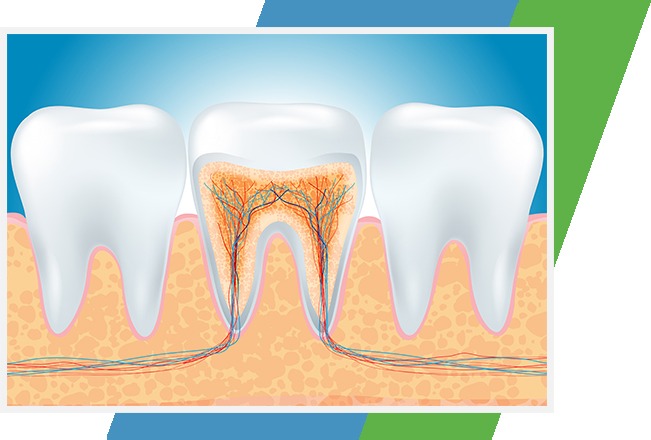 Root Canal Therapy | Sana Dental | General & Family Dentist | North Edmonton