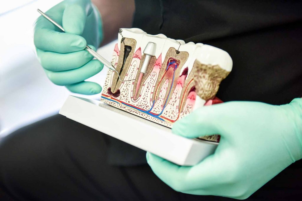 Dental Implant Education | Sana Dental | General & Family Dentist | North Edmonton