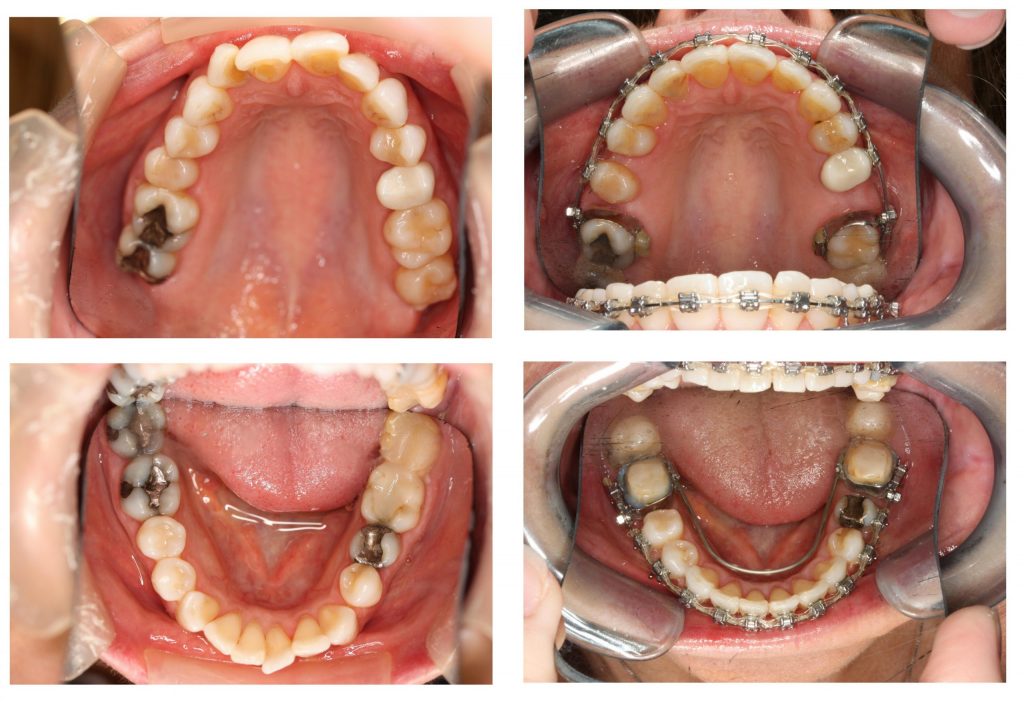 Adult Epigenetic Orthodontics | Sana Dental | General & Family Dentist | North Edmonton