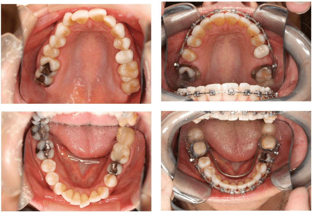 Adult Epigenetic Orthodontics | Sana Dental | General & Family Dentist | North Edmonton