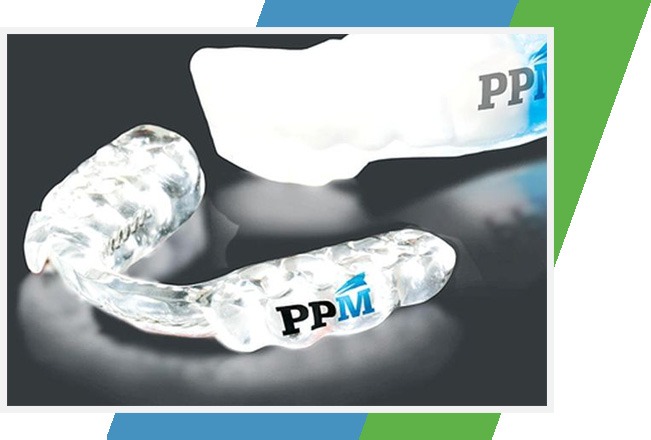 PPM Mouth Guard | Sana Dental | General & Family Dentist | North Edmonton